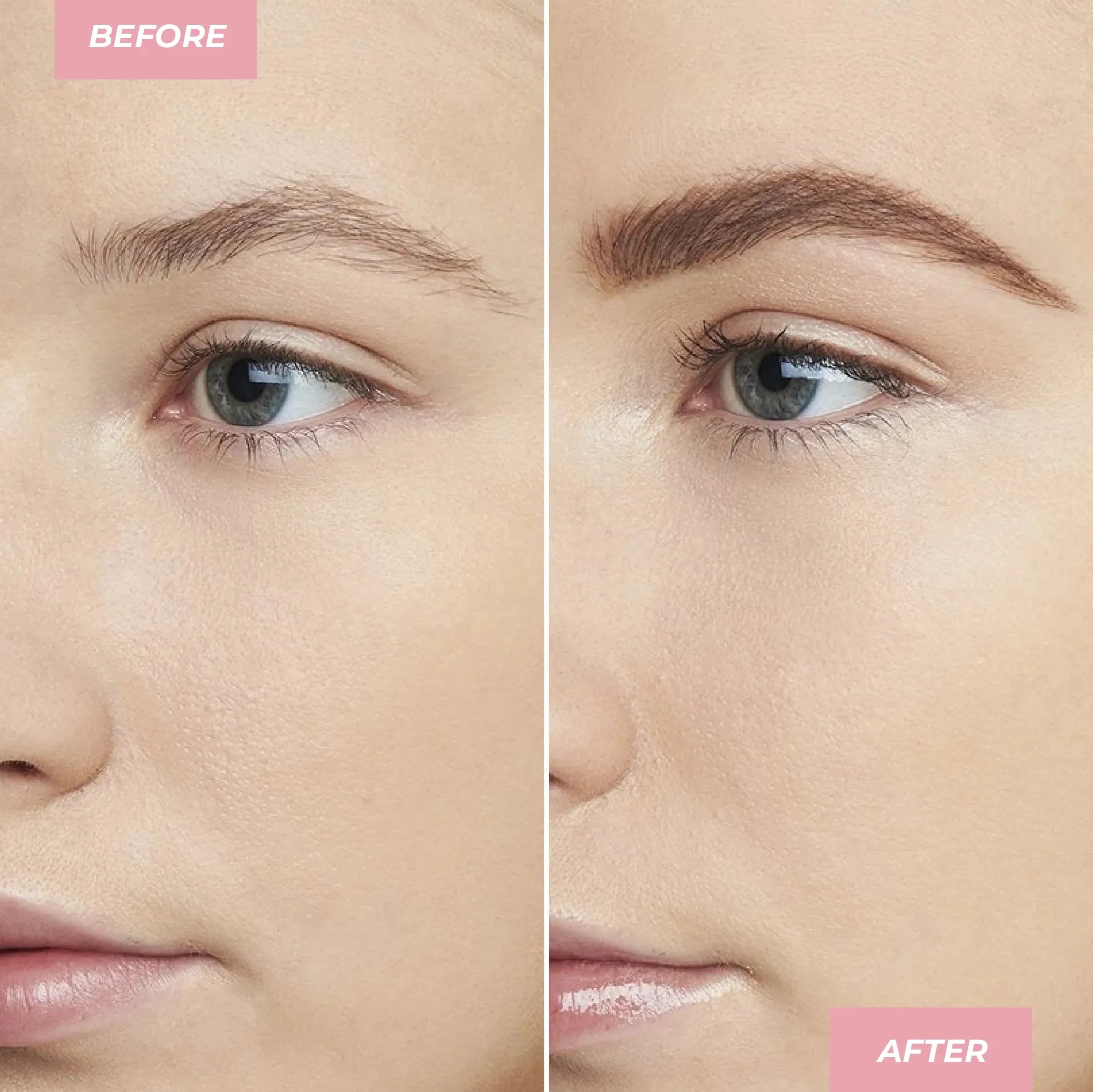 XtendBrows Treatment Gel